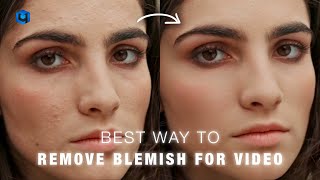 How to Remove Blemishes from Your Video in Seconds  Retouch4me Davinci Resolve Studio [upl. by Nalehp]