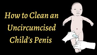 How to Clean an Uncircumcised Childs Penis [upl. by Richie]