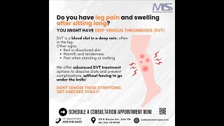 Leg Swelling Might be Deep Venous Thrombosis [upl. by Hras]