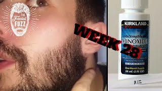 How To Apply FOAM MINOXIDIL For Your BEARD [upl. by Nassi]