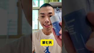 Nuskin 奇蹟霜七天實測，真的能改善痘疤嗎？實測 痘疤 成長型思維 [upl. by Suissac194]