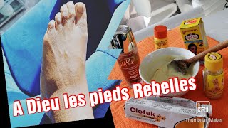 Dite a Dieu aux pieds rebelles en 5 jours [upl. by Nalloh641]