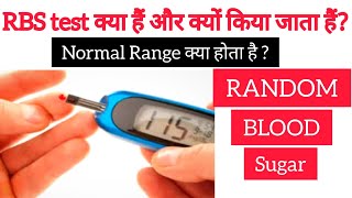 RBS Test क्या है और क्यों किया जाता है  Random Blood Sugar Test  RBS Test in Hindi [upl. by Tjaden]