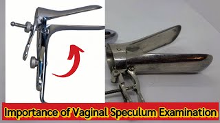 Importance of Vaginal Speculum Examination♀️ [upl. by Aara]