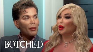 Amazing Transitions on Botched Rodrigo Alves  Botched  E [upl. by Anitsrik]