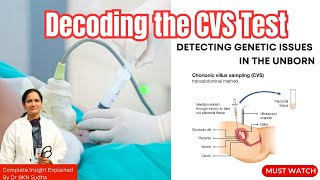 Decoding the CVS Test Detecting Genetic Issues in the Unborn  Dr BKN Sudha’s Expert Insights [upl. by Yvonne]