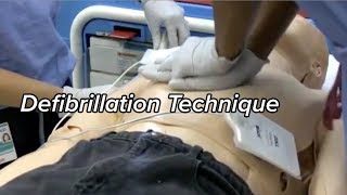 How to Defibrillate  Defibrillation Technique [upl. by Atiuqahs]