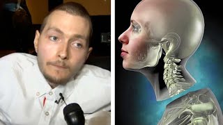 What Happened To The First Human Head Transplant Feat Medlife Crisis [upl. by Bay574]