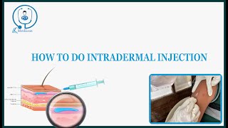 HOW TO DO INTRADERMAL INJECTION  INTERNS GUIDE [upl. by Teragramyram]