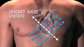 Parasternal Short Axis Views [upl. by Halliday]