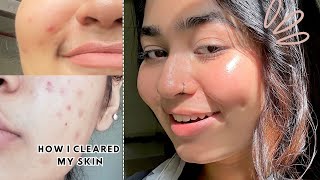 How I cleared my acne marks✨ Rodoshi  Vlog 07 [upl. by Adnoel]