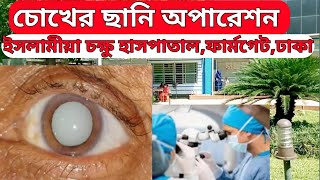 ছানি অপারেশনের খরচ cataract surgery cost Types of cataract surgery Cataract Surgery ছানি অপারেশন [upl. by Palmira419]