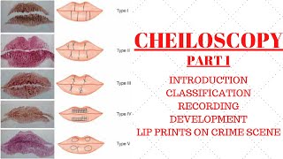 Cheiloscopy  Study of lip prints  Suzuki and Tsuchihashi Martin santos classification  Notes [upl. by Pilif106]