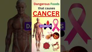 Dangerous foods that causes CANCER [upl. by Orel429]