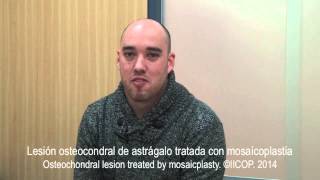 TESTIMONIO PACIENTE OPERADO DE OSTEOCONDRITIS DE ASTRAGALO [upl. by Ylim]