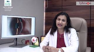 Dr Aditi Manudhane discusses About Keratoconus – Its Symptoms Causes And Treatment  Lybrate [upl. by Lekkim]