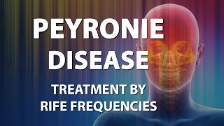 Peyronie Disease  RIFE Frequencies Treatment  Energy amp Quantum Medicine with Bioresonance [upl. by Tisbe858]