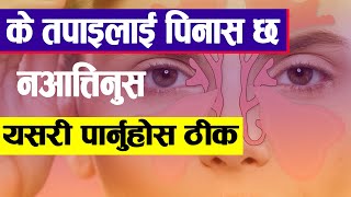 डेंगु रोगको लक्षण र बच्ने उपाय  Symptoms prevention and treatment of dengue in Nepali [upl. by Marolda]