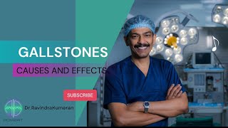 GALLSTONE  Everything about Gallstone and its causes and effects  Admert Medical Centre [upl. by Arocahs338]