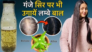 30 Days Bhringraj Hair Growth Challenge  Stop Hair Fall amp Regrow Hair Faster Longer amp Thicker❤️ [upl. by Dehlia]