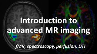 An Introduction to Advanced MRI techniques fMRI spectroscopy perfusion amp diffusion tensor imaging [upl. by Monro]