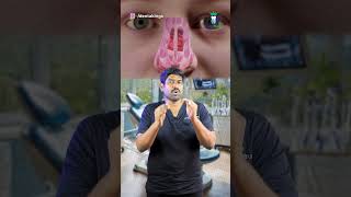 வாய் வழியாக மூச்சு விடுவதை தடுப்பது எப்படி How to Stop Mouth Breathing Habit Denta Kings shorts [upl. by Nomal]