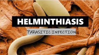 HELMINTHIASIS [upl. by Aiselad821]