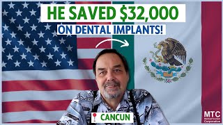 Review – Dental Implants in Cancun Mexico [upl. by Ynoep915]