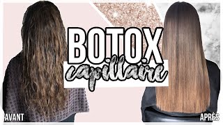 JE TESTE LE BOTOX  1 MOIS PLUS TARD  😱🤩 [upl. by Eus]