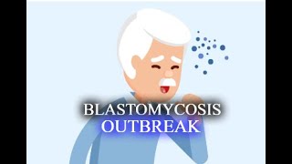 The Blastomycosis Outbreak [upl. by Corry]