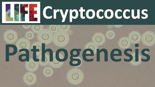 Cryptococcal meningitis pathogenesis and host response [upl. by Guilbert]