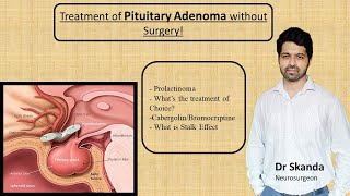 Pituitary Adenoma  Non Surgical treatment Cure without Operation Prolactinoma By Dr SkandaNSx [upl. by Nongim]