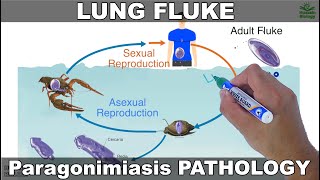 Paragonimiasis  Lung fluke and its Life Cycle [upl. by Vish]