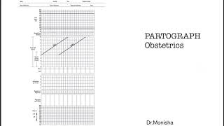 How to read a PARTOGRAPH  Obstetrics [upl. by Ynhoj]