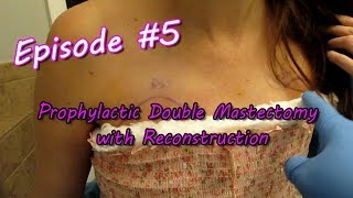 Ep 5 Double Mastectomy with Reconstruction [upl. by Gipps]