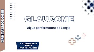 Glaucome aigue par fermeture de langle Rappel physiopathologie formes cliniques DC positif CAT [upl. by Alvita322]