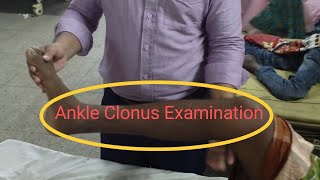 Ankle Clonus Examination [upl. by Dagna510]