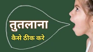 तुतलाना कैसे ठीक करे ll tutlana in hindi ll tips and techniques ll online acting guru ll sadiqsir [upl. by Collins]