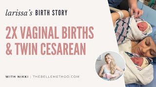 Larissas Birth Stories 2 Vaginal Births followed by Twin Cesarean [upl. by Nuriel569]