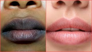 COMO ACLARAR LOS LABIOS OSCUROS REMEDIO CASERO MUY EFECTIVO [upl. by Anirt]