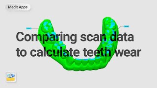 歯の摩耗度計測のためスキャン・データを比較する方法（Medit Designアプリ使用） [upl. by Keffer]