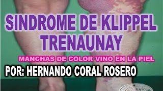 SINDROME DE KLIPPEL TRENAUNAY  MANCHA DE COLOR VINO EN LA PIEL [upl. by Sauls]