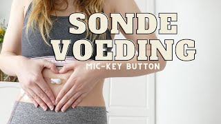 Sondevoeding en MICKEY button EN amp NL CC [upl. by Daph]