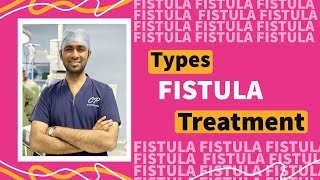 Fistula Treatment Options  Best Technique kaunsi hai [upl. by Jamison]