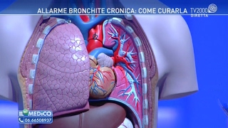 Allarme bronchite cronica come curarla [upl. by Ahsuat886]