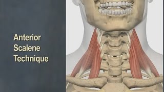 Therapeutic Massage for Anterior Scalene Muscles [upl. by Nnylarak615]