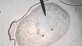 Live Fish Parasite Under a Microscope [upl. by Nylsirhc449]