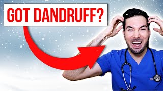 How to get rid of dandruff permanently at home and treatment [upl. by Mendes]