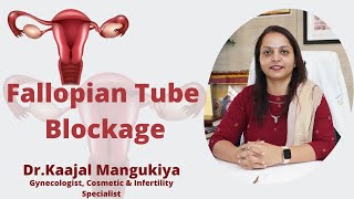 Fallopian Tube Blockage Symptoms Causes Diagnosis and Treatment  DrKaajal Mangukiya [upl. by Agler]