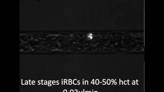 Margination of late stage infected red blood cells [upl. by Ayomat772]